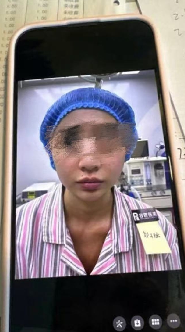 美容致毁容抑郁,花季少女被忽悠至郑州悦容整形医院造成身心创伤